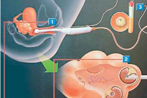 体育指导与管理