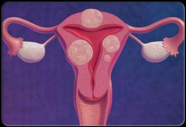 体外受精胚胎移植